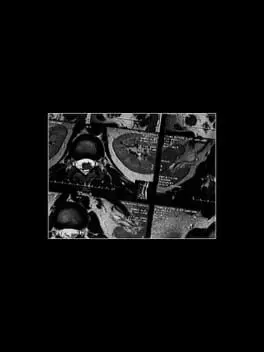 Nihilist Syndrome cover