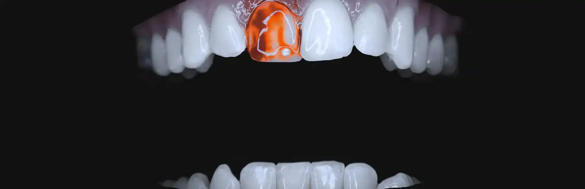 Teeth Cutter background